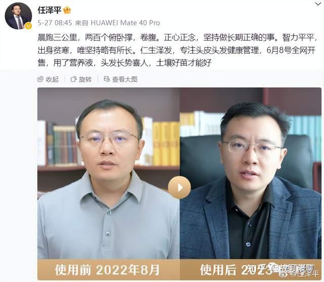 任泽平如此高调地代言一款生发产品,算不算是一种财富险中求?