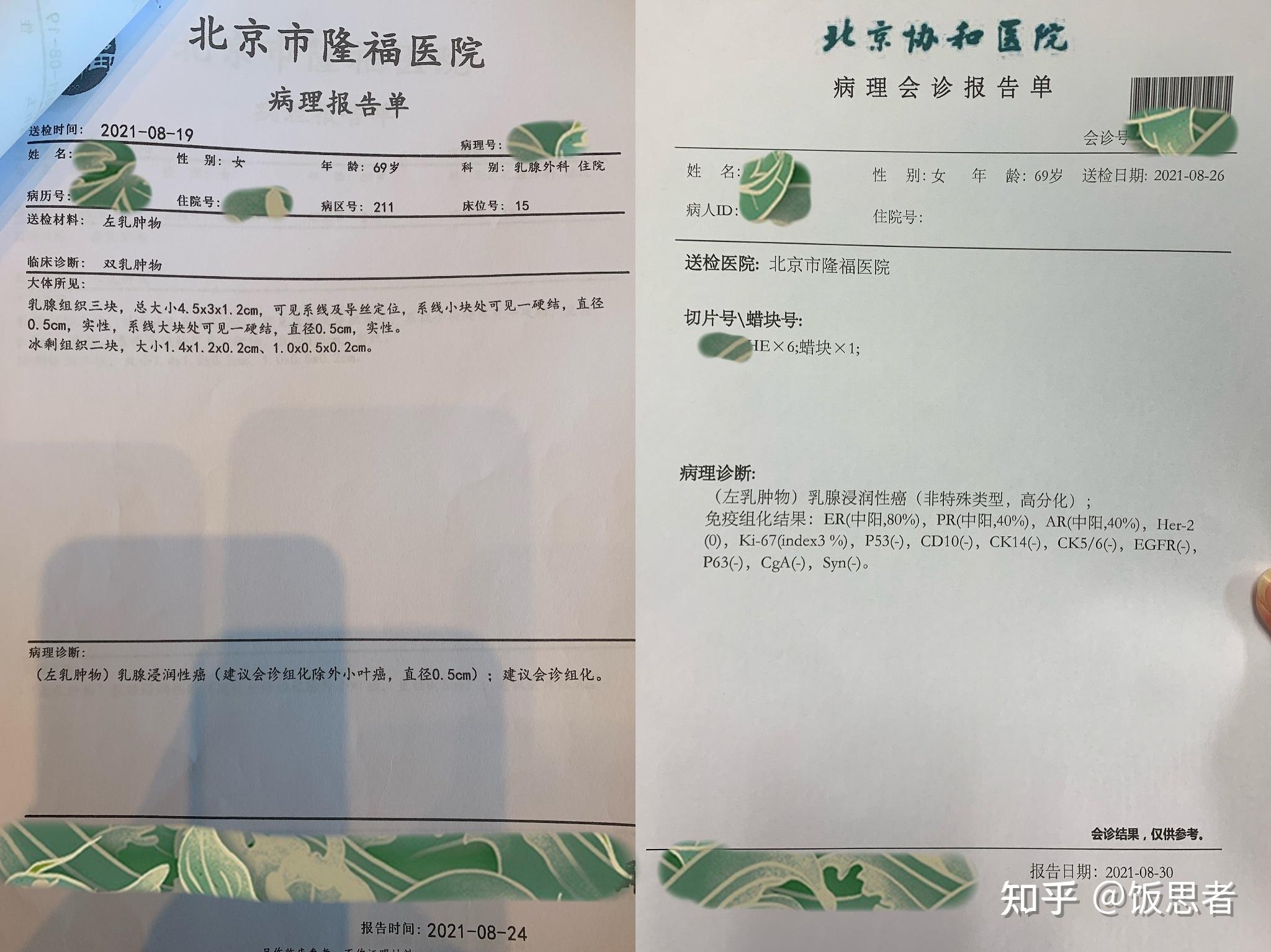 同时把免疫组化的结果给乳腺外科医生做了备案,去病案室复印了病历