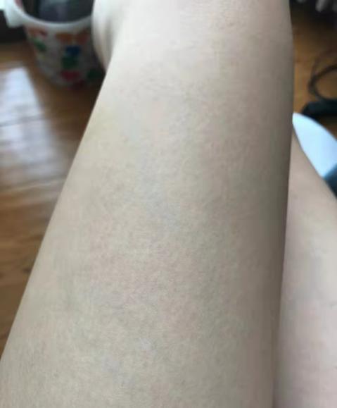 有没有真正脱毛的好办法