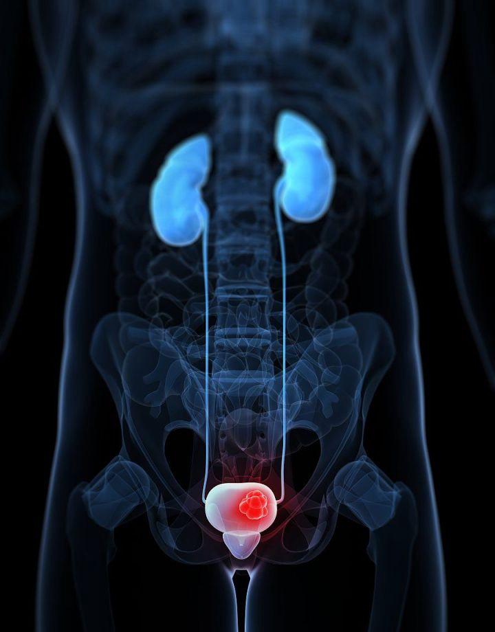 v2-07a4b29049062c98f918cb9cca36d516_1440w.jpg?source=172ae18b