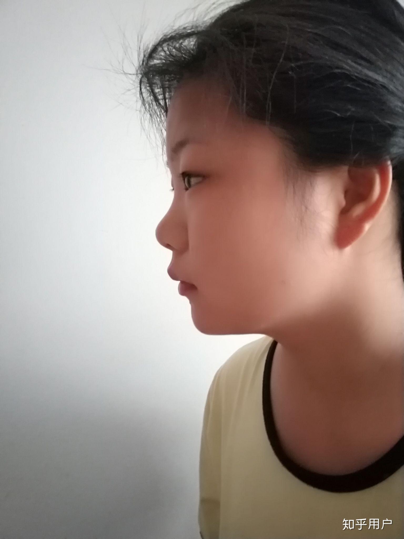 侧脸丑而正脸好看是一种什么体验