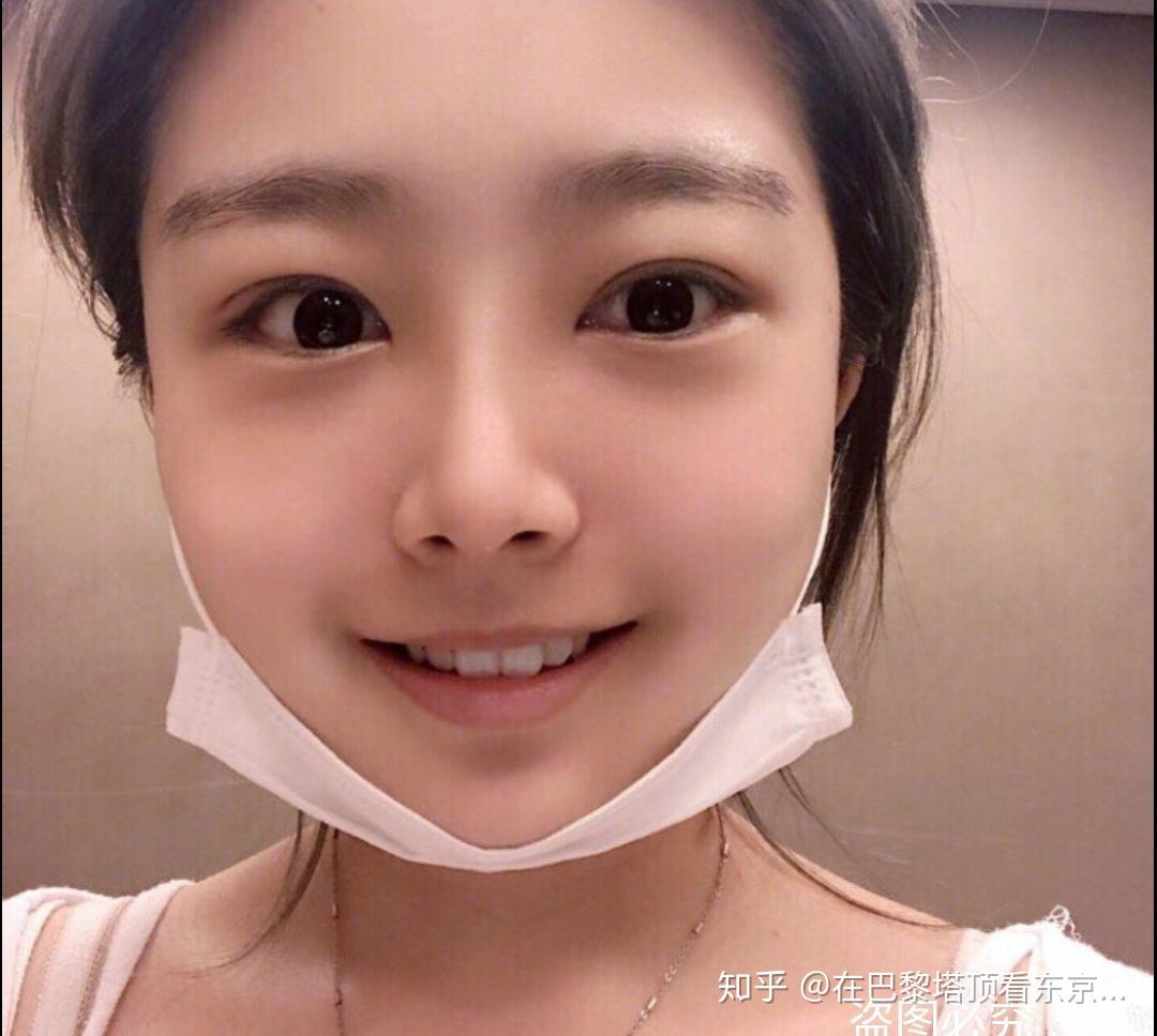 割双眼皮有什么危险吗?