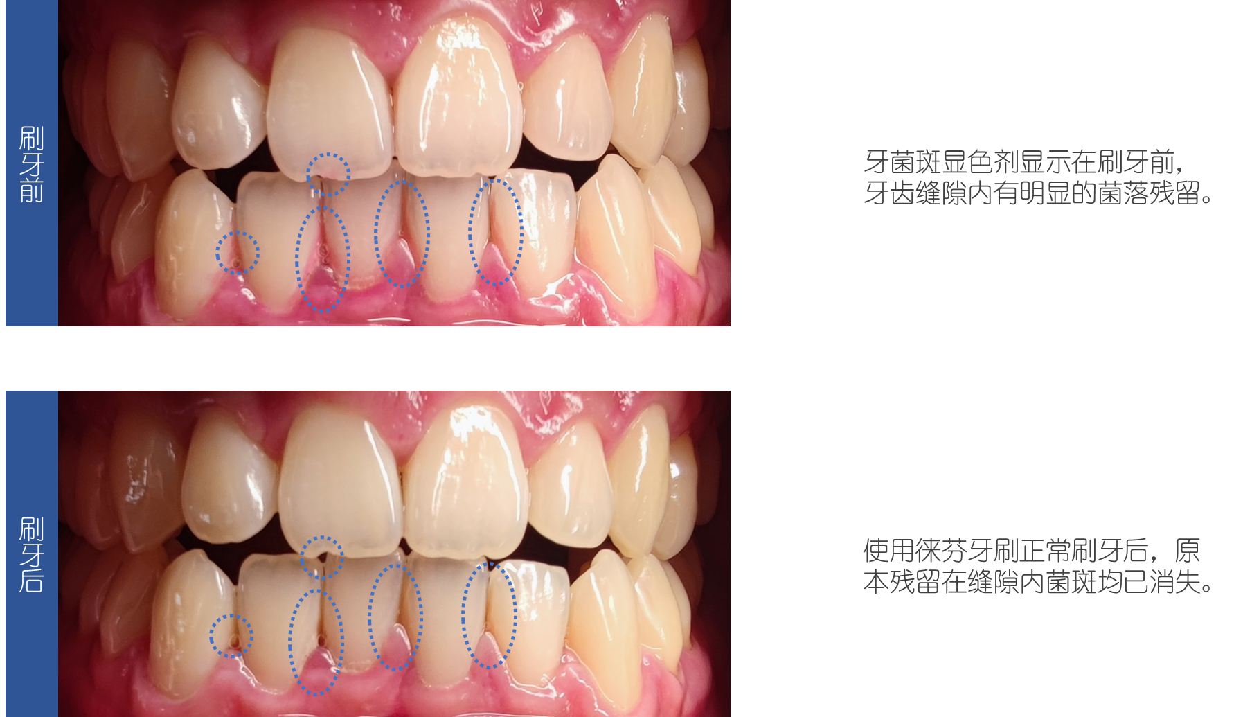 v2-081fea958718870be748f900f5c0fd3a_r.jpg