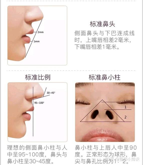鼻综合整形项目包含哪些？
