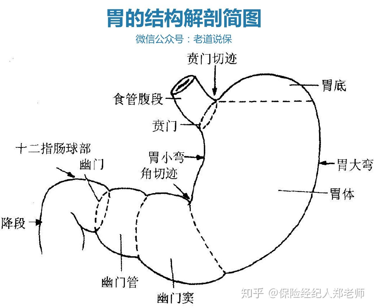 慢性胃炎、萎缩性胃炎，可以买保险吗？ 知乎 