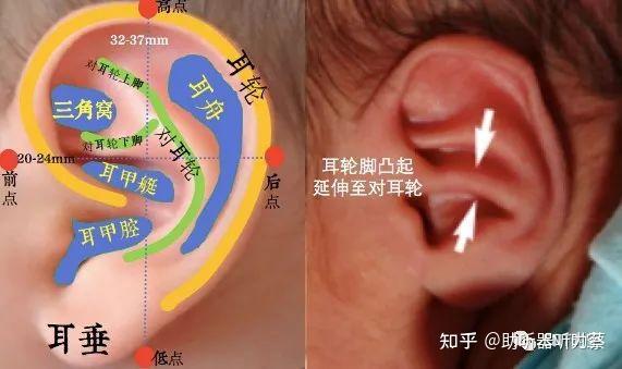 耳轮相学图片