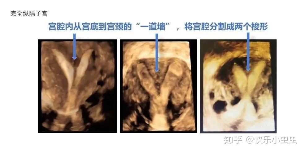 三维世界里的子宫