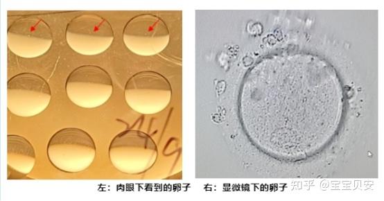 卵子肉眼可以看见吗?