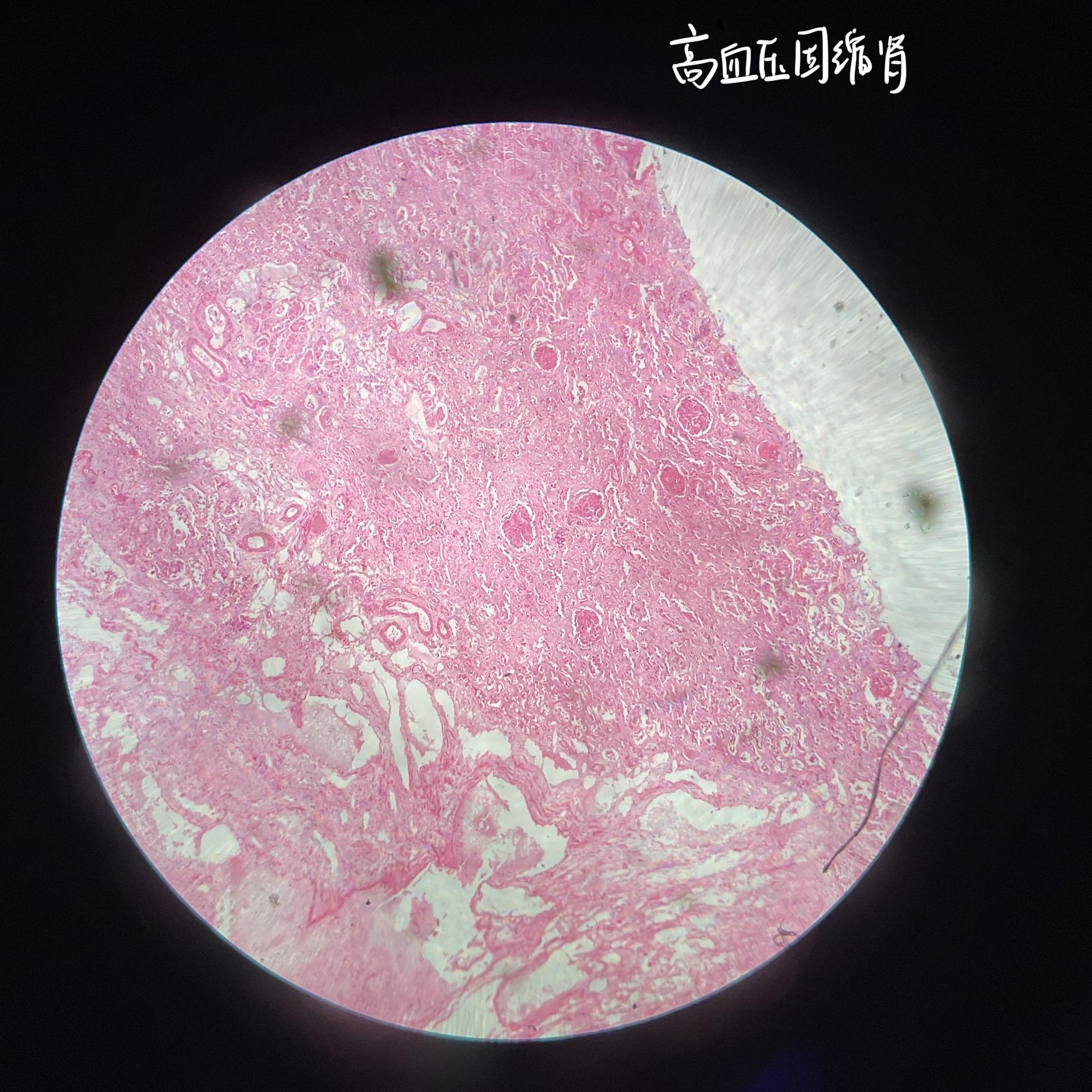 病理学实验(下) 