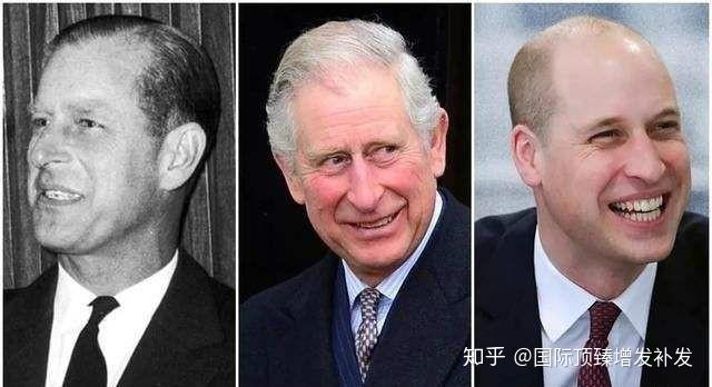 种头发的费用贵吗大约多少钱呢