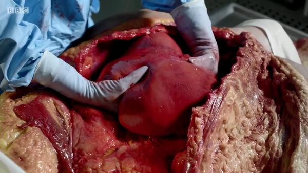 解剖尸体法医是如何解剖尸体的呢法医尸体解剖全过程解密