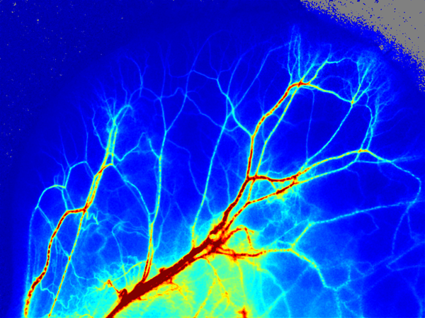 真实案例：散斑用户的使用感受分享 - 知乎