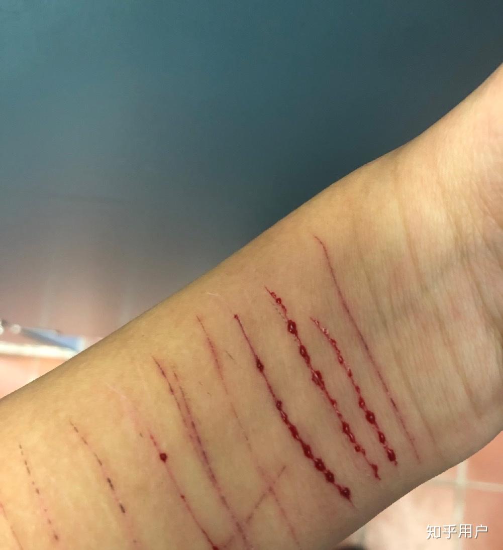 为了一个男生自残值得吗