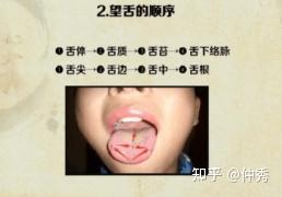 中医舌诊详解大全（独家讲义） - 知乎