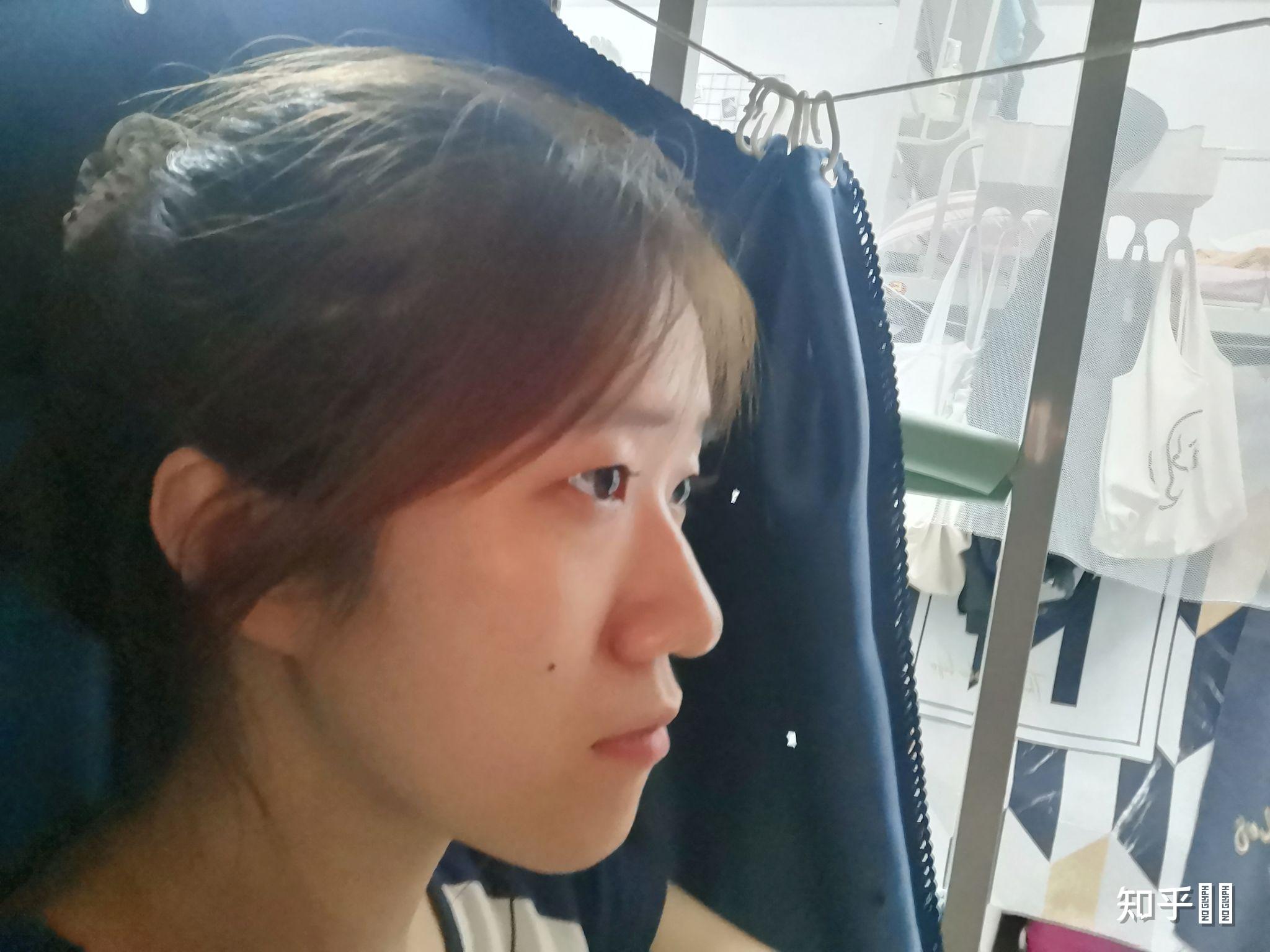 山根低鼻梁高是怎样的体验