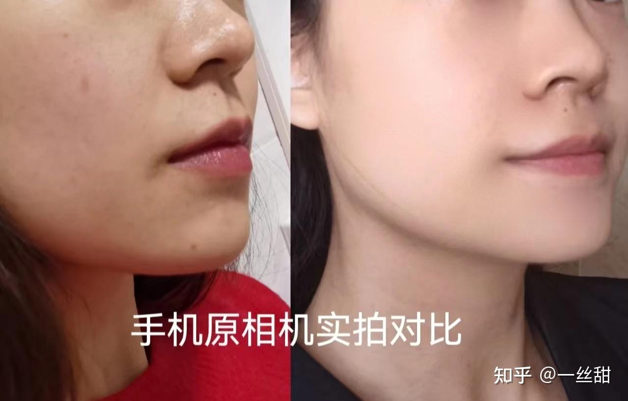 的前后对比↓↓↓从皮肤差,暗黄无光泽到现在皮肤细腻,胶原蛋白满满