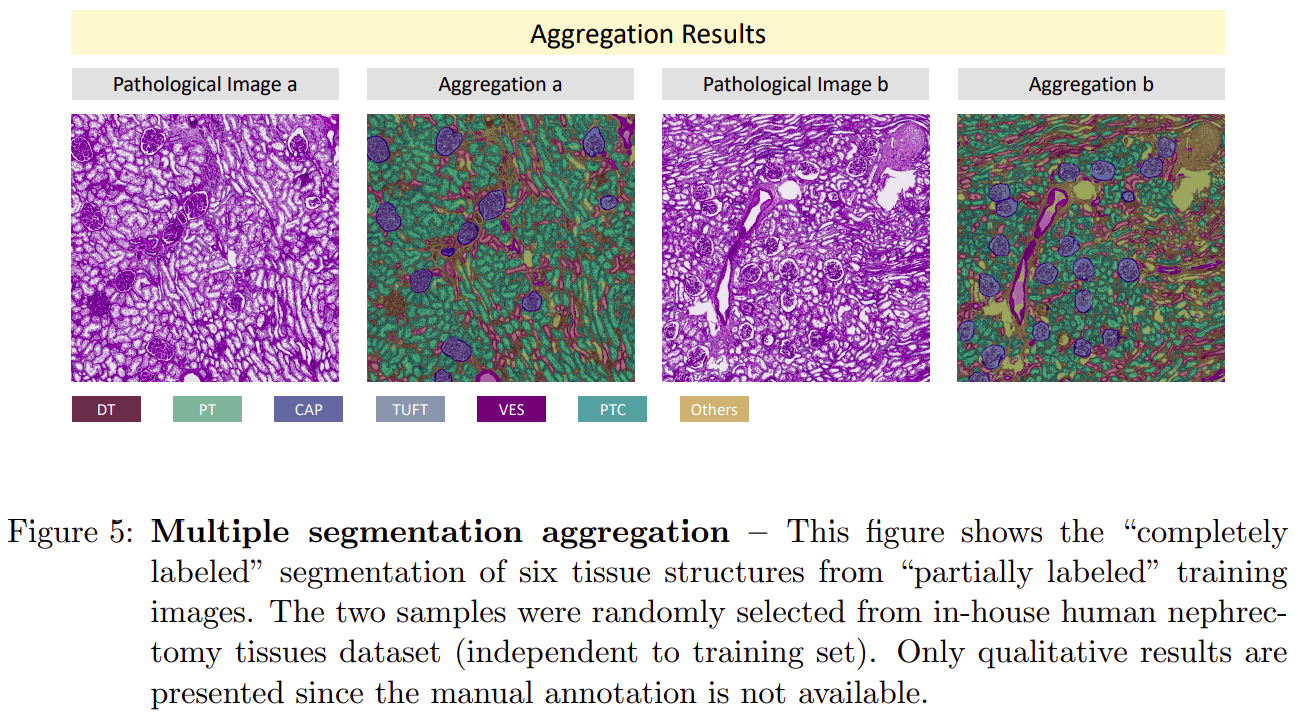 【arXiv:2112】Omni-Seg：使用部分标记数据进行多标签肾脏病理图像分割的单一动态网络 - 知乎