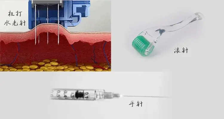 机打水光针滚针手针能同一天打吗