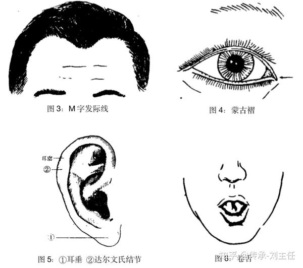 秃顶、双眼皮、肤色......孩子的外貌特征，遗传自爸爸还是妈妈？ - 知乎