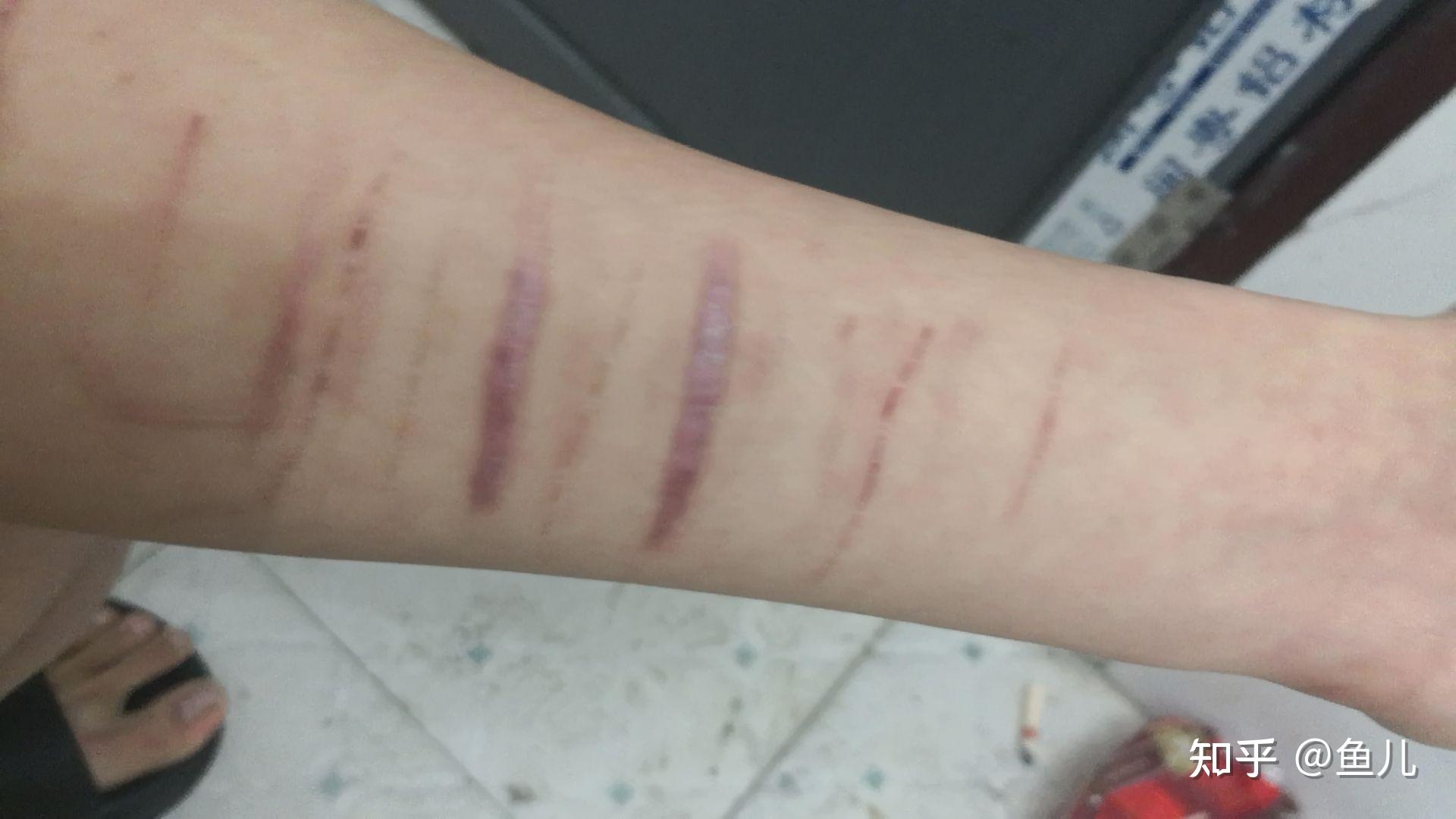 就想知道夏天搭配什么衣服让人看不到我手上的伤疤