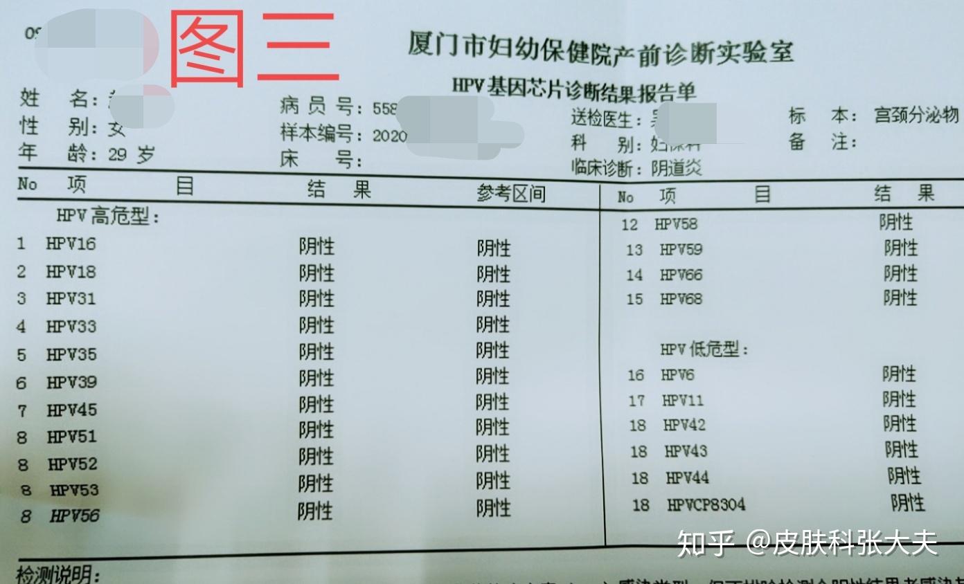 厦门市赵女士hpv31hpv45型高危转阴病例分享