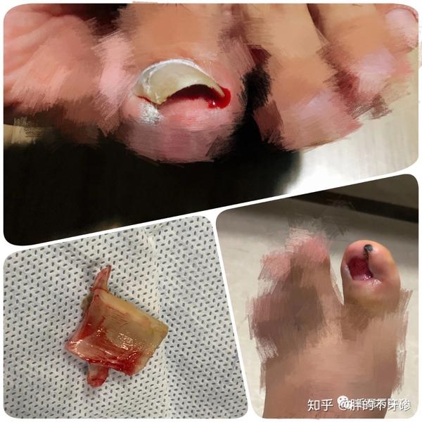 风险无处不在,做梦都会发生