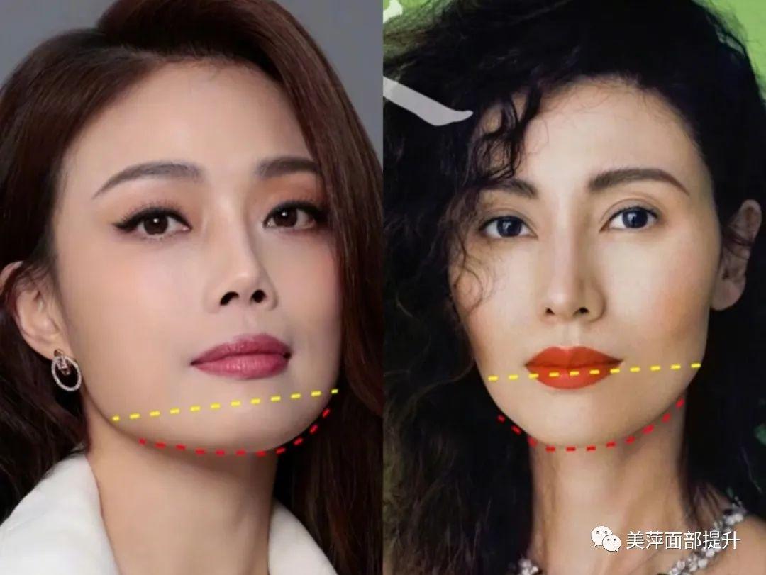 下巴填充怎么才好看？这6种脸型下巴形态搭配你一定要知道！ 知乎 