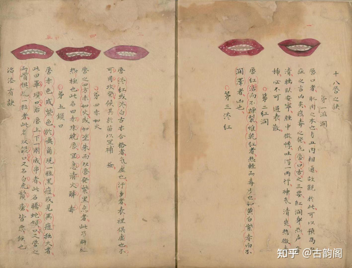 中医古籍《戴曼公唇舌秘方》手抄绘 - 知乎