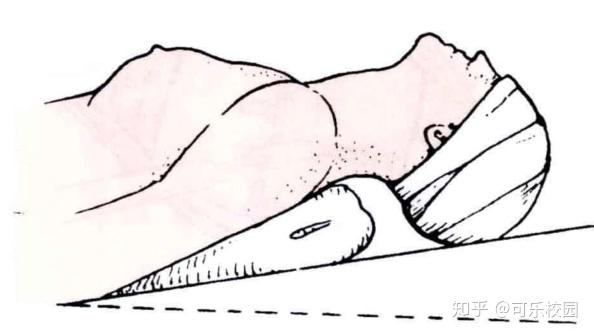 病人取仰卧位,肩下垫枕,头部后仰,两侧放置沙袋固定