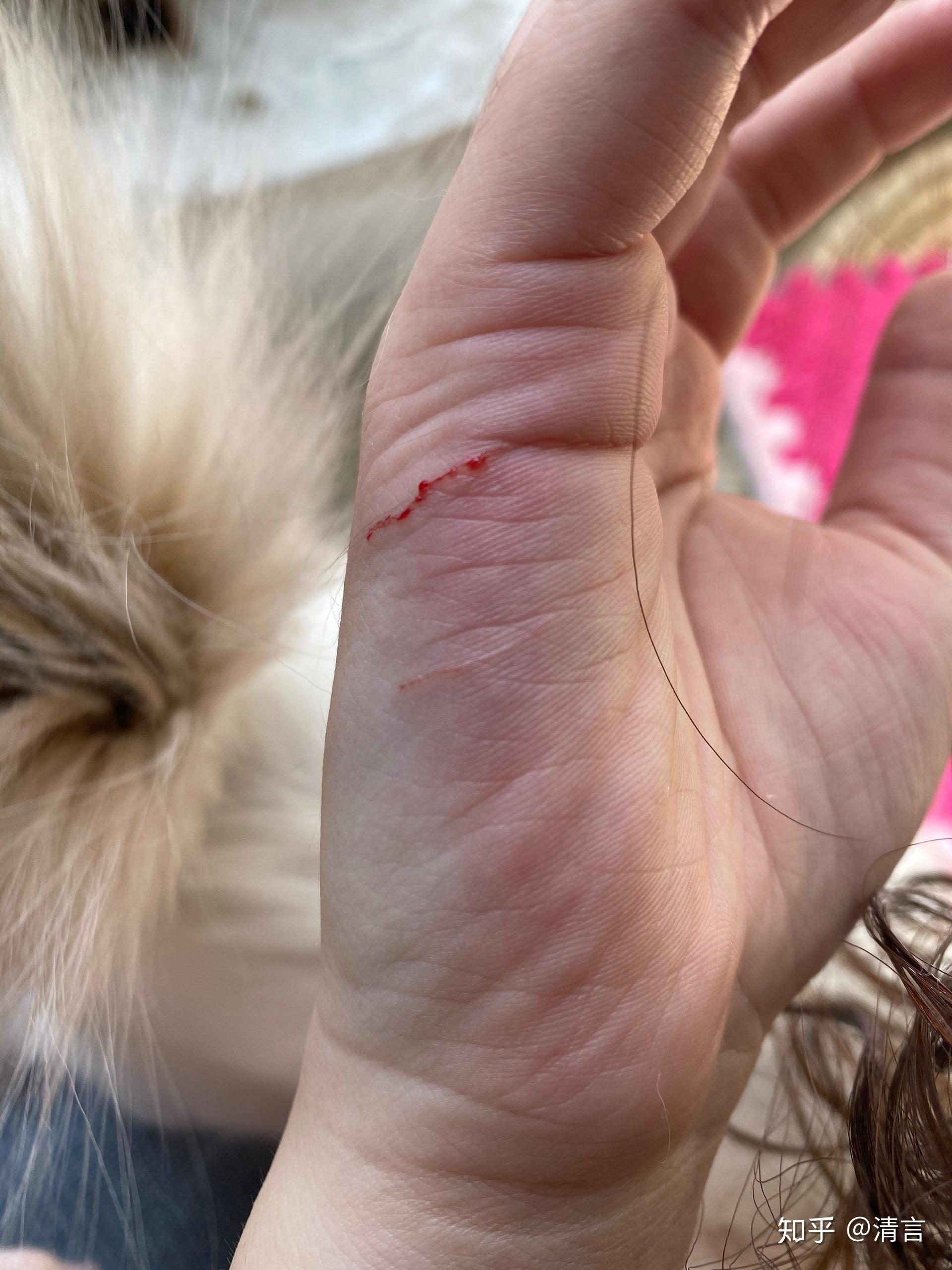 家养没出过门的猫咪抓伤需要打狂犬疫苗吗