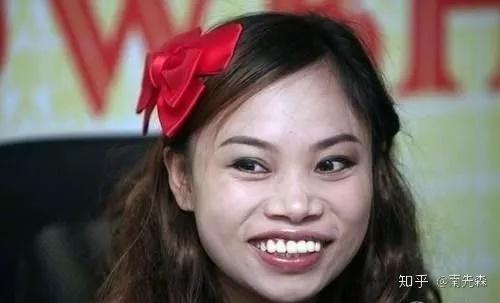 这些情况下,有人不要奢望戴牙套就可以变美,变男神,女神:有人戏称凤姐