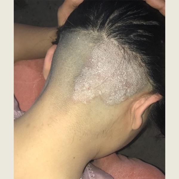 什么洗发膏去屑好?洗发水止痒去屑推荐 - 知乎