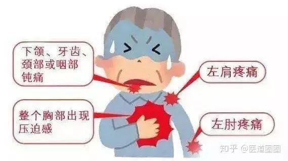 一,变异型心绞痛的临床表现,检查与治疗