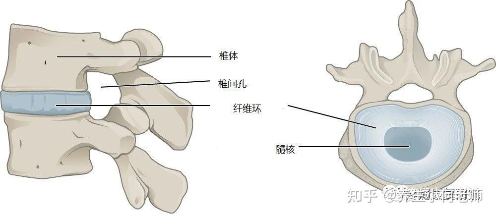 腰椎间盘突出症的相关解剖、诱因、症状、诊断及体格检查和治疗 - 知乎