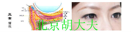 怎样去除泪沟？如何选择适合自己的方法 - 知乎
