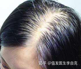 v2-0ce8c4e977336a5f49535f7cadcd3b36_b.jpg
