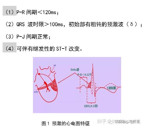 预激综合征心电图少见表现与诊断思路