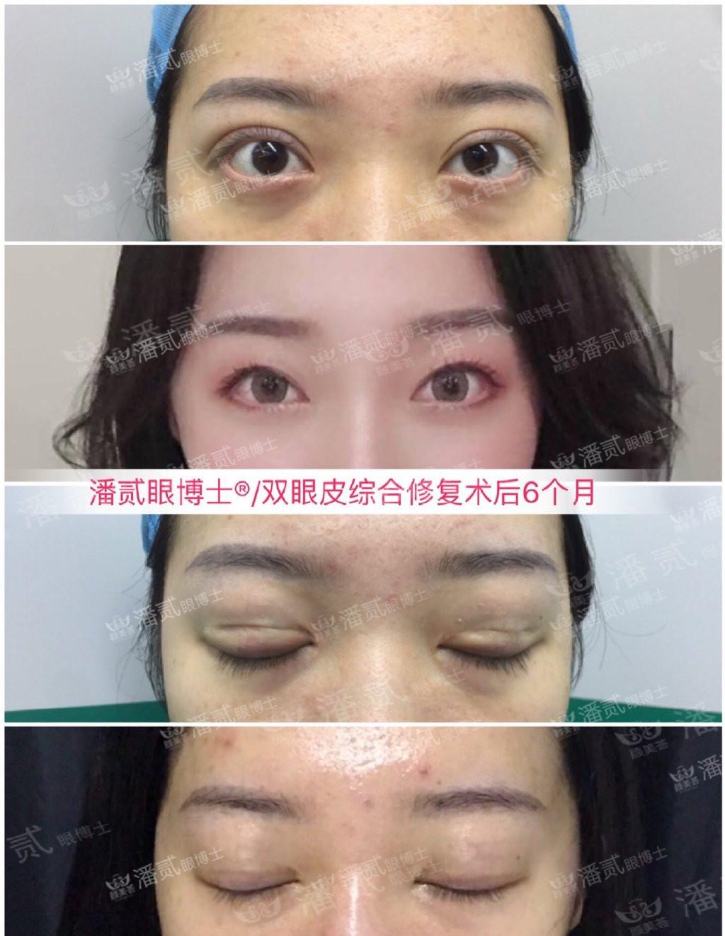 怎么把肉切薄 v2-0d371a3c822cf8114aff2b7e1526ecde_r.jpg