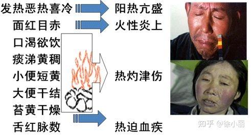 教你八纲辨证和脏腑辨证,提升临床能力 - 知乎