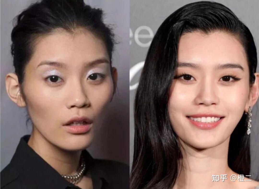 额头填充美商指南|什么样的额头才最好看？为什么露额头的都是大美女？ - 知乎