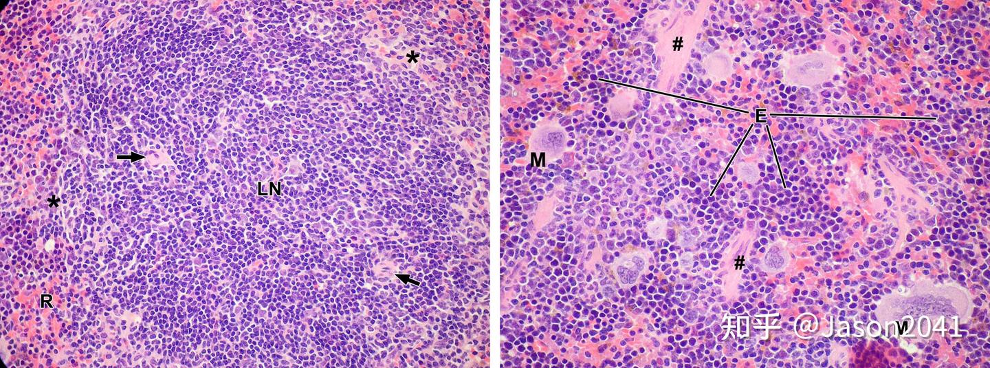 脾的组织结构 - 知乎
