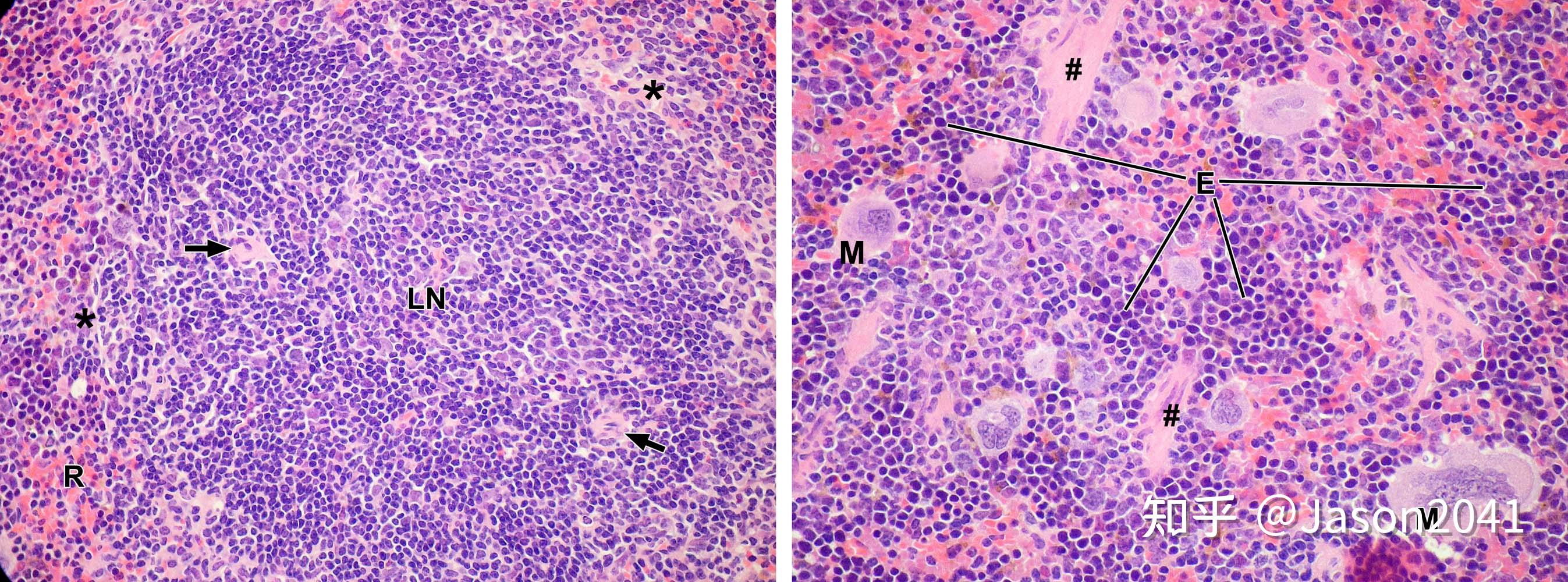 脾的组织结构 - 知乎