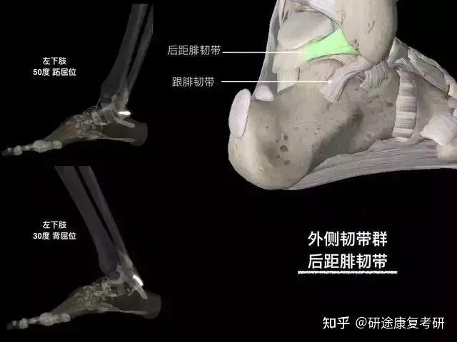 康复基础 | 33张踝关节解剖高清图解,收藏必备! - 知乎