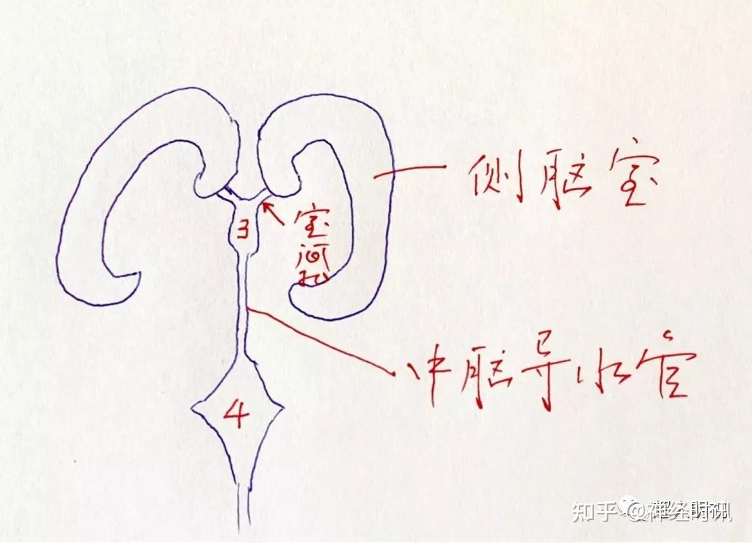 侧脑室中央部图片