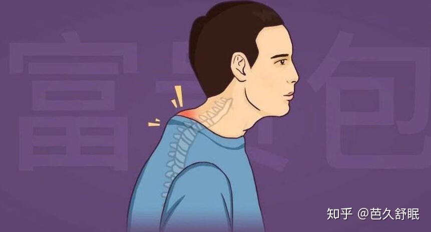 怎么样消除富贵包最有效的方法 v2-0e2245347c01aad39581cd17ab76629e_r.jpg