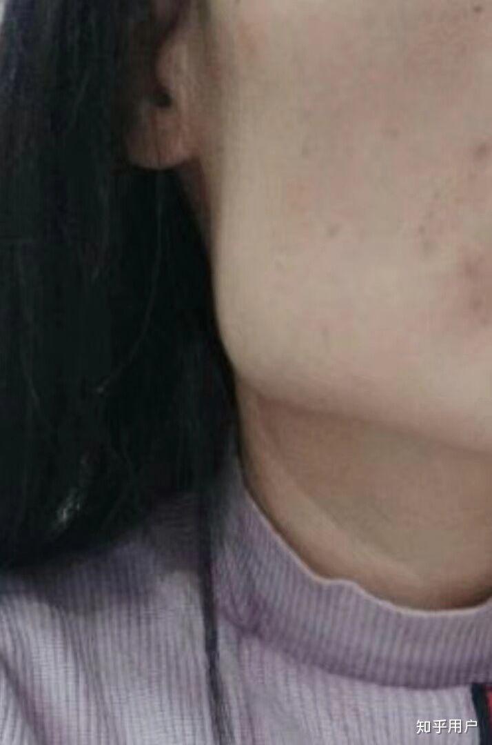 怎样减肥不垮脸 v2-0e3e66b6691821a32537a4d08a95197c_r.jpg