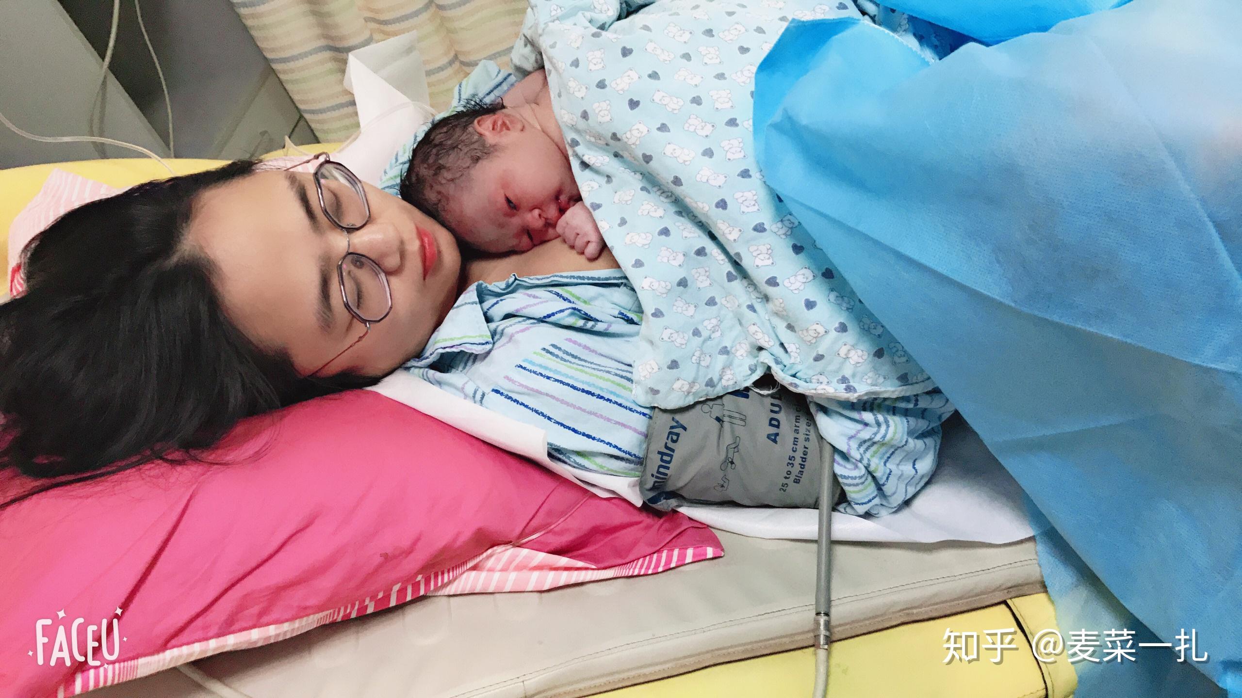 顺产剖腹产到底哪个好？