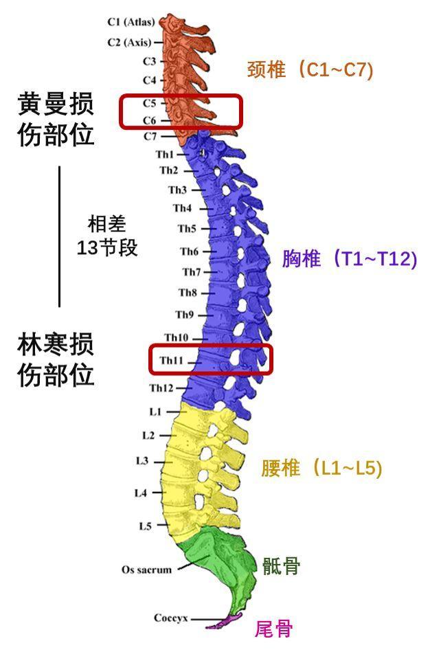 脊柱是人体的支柱.