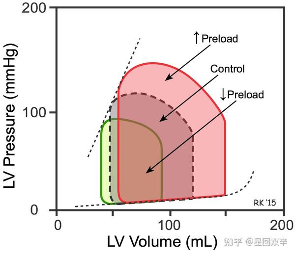 pulmonary-wedge-pressure-wikiwand