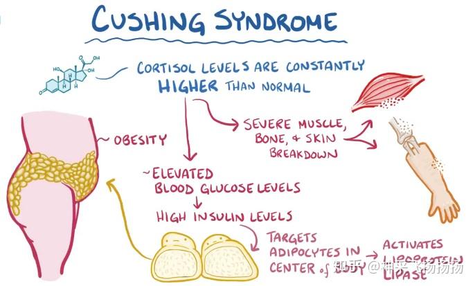 医学科普之库欣综合征cushingsyndrome